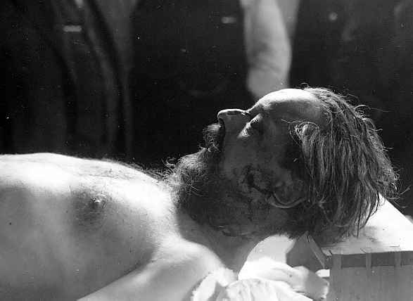 Ohledn zavradnho v marinskolzesk nemocnici - 31.VIII.1933