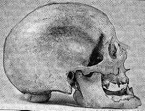 Goethovo muzeum povolilo zveejnn pouhch dvou fotografi z exhumace velkho bsnka. Jednou z nich je snmek lebky.